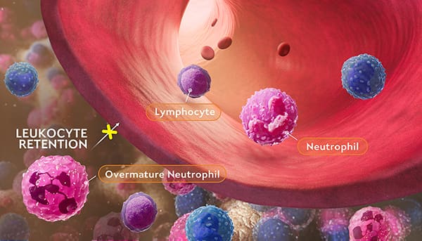 Scientific illustration of CXCR4 pathogenic variants causing hyperactive CXCR4 signaling leading to retention of leukocytes in the bone marrow.